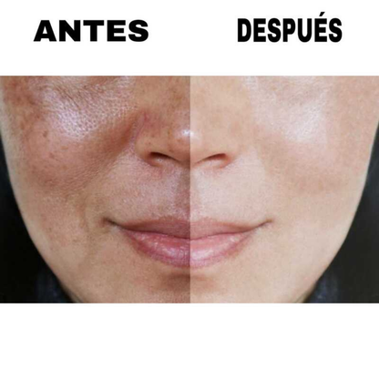 Aceite De Rosa Mosqueta Rejuvenece